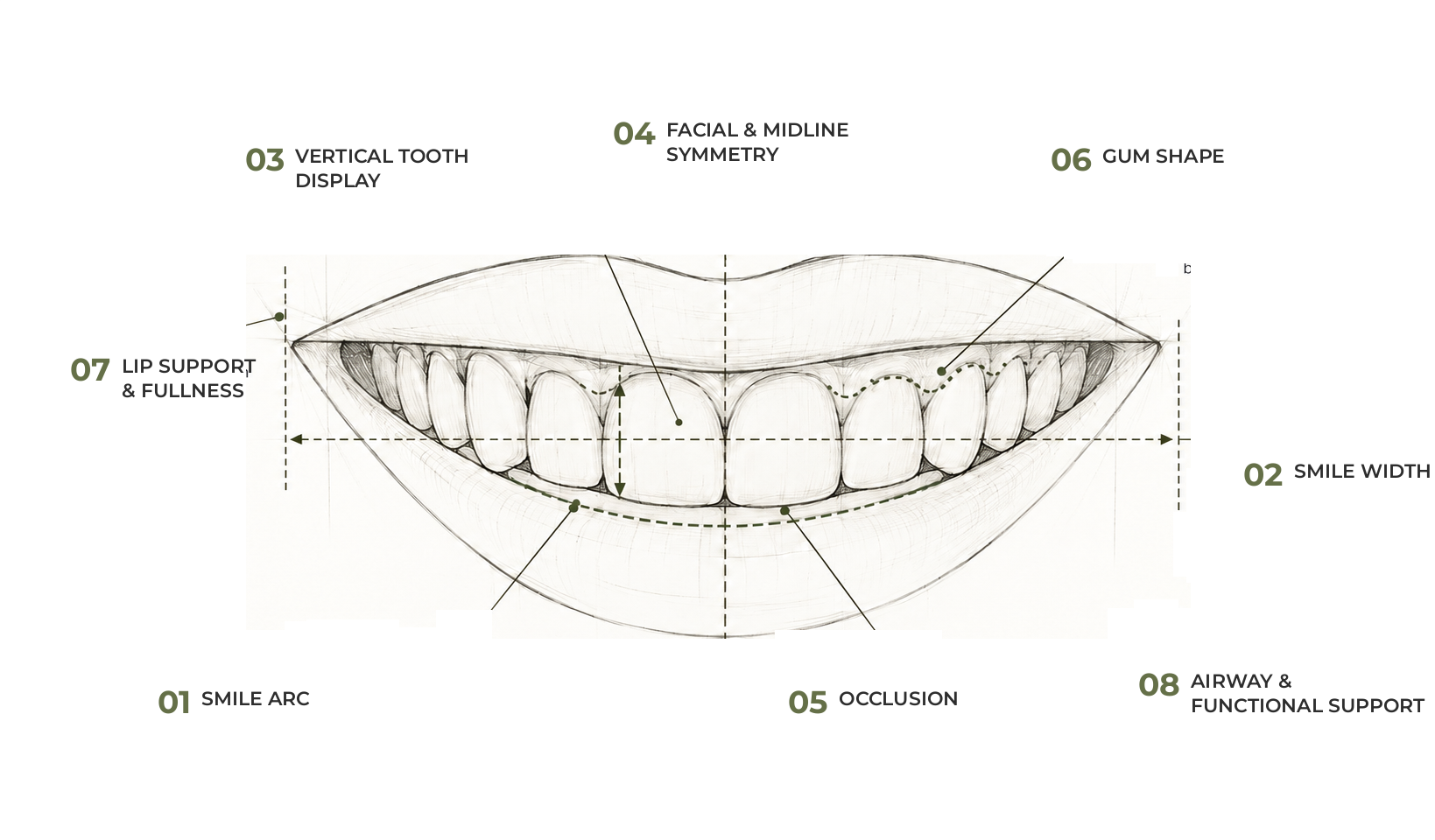 Hand-drawn sketch of a smile with orthodontic blueprint annotations